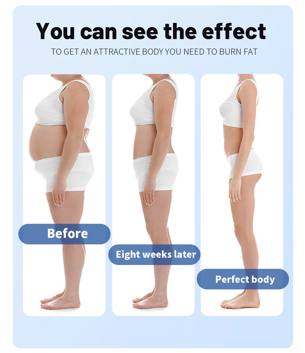 EMS Myoslim Radio Frequency Body Sculpting Device - Image 5